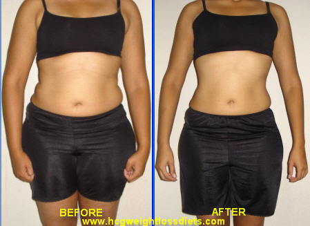 hcg diet before and after photographs